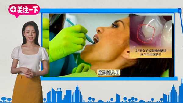 27岁女子长期横向刷牙致牙齿缺损