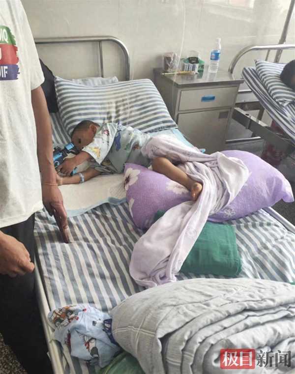 缅北4岁半男童被炮弹炸伤来中国治疗