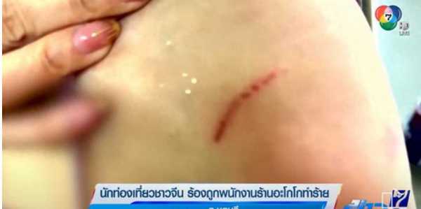 中国夫妻在泰国遭多人围殴!包内贵重物品丢失