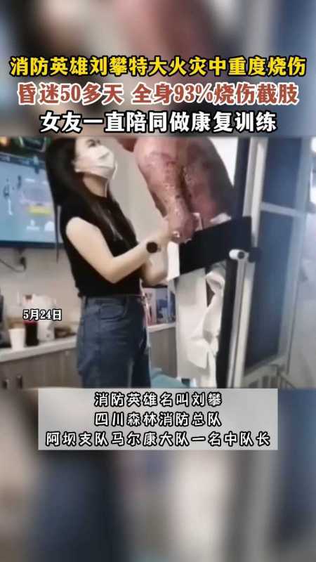 重度烧伤消防员刘攀女友宣布怀孕