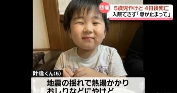 日本烫伤男孩遭医院拒收后发烧去世